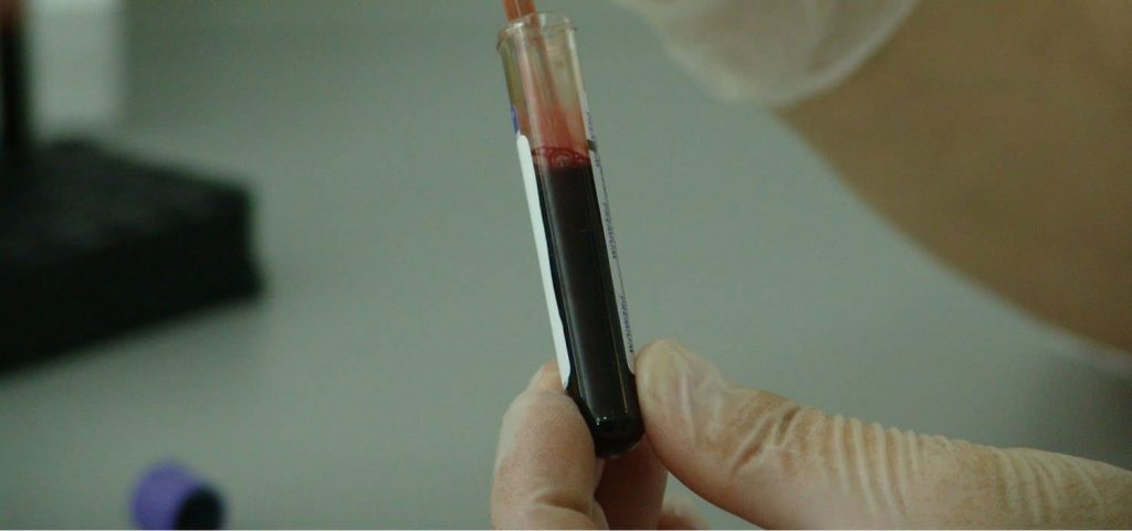 A vial filled with blood is being held by a person wearing latex gloves