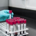 Test tubes with blood samples are being placed in a holder