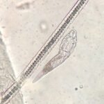 How molecular testing is reshaping the way parasites can be detected