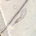 How molecular testing is reshaping the way parasites can be detected