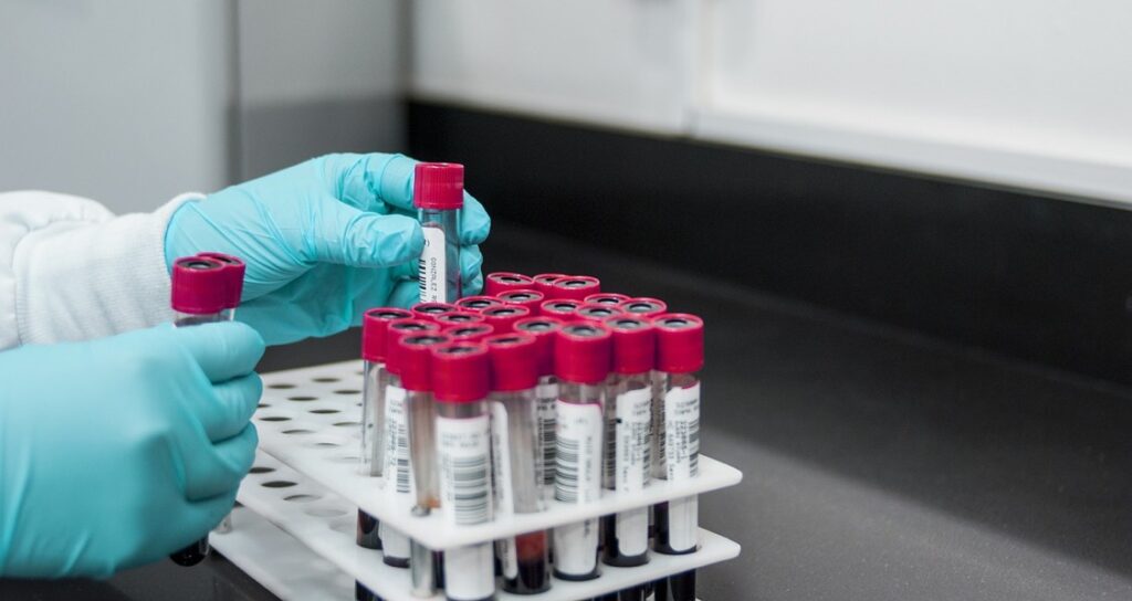 Red vacutainers containing blood are being placed in a tube rack