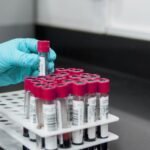 Liquid Biopsy: The Future of Cancer Detection in Dogs?